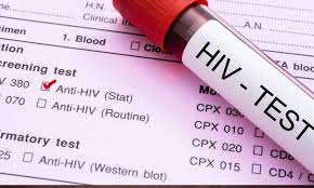 Cerca de dois milhões de moçambicanos vivem com o vírus